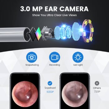 Teslong SA-39A Camera Wireless Otoscope IP67 Endoscope Camera 3.9mm Otoscopio Visual Ear Wax Remover - Image 3