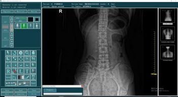 Wireless X-Ray CSL-14X17 FPD Flat panel Detector DR/Portable SONTU 50 Series - Image 3