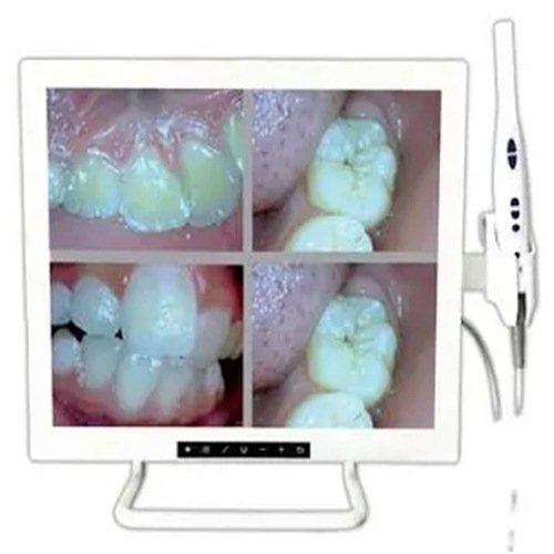 Dental intra-oral camera